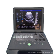 Laptop 15 inch 4D Color Doppler Ultrasound Machine for OB/GYN